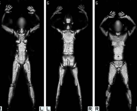 bodyscan